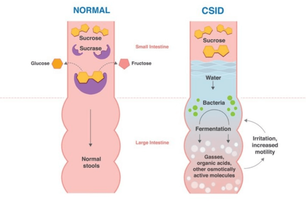 normal digestion symptoms