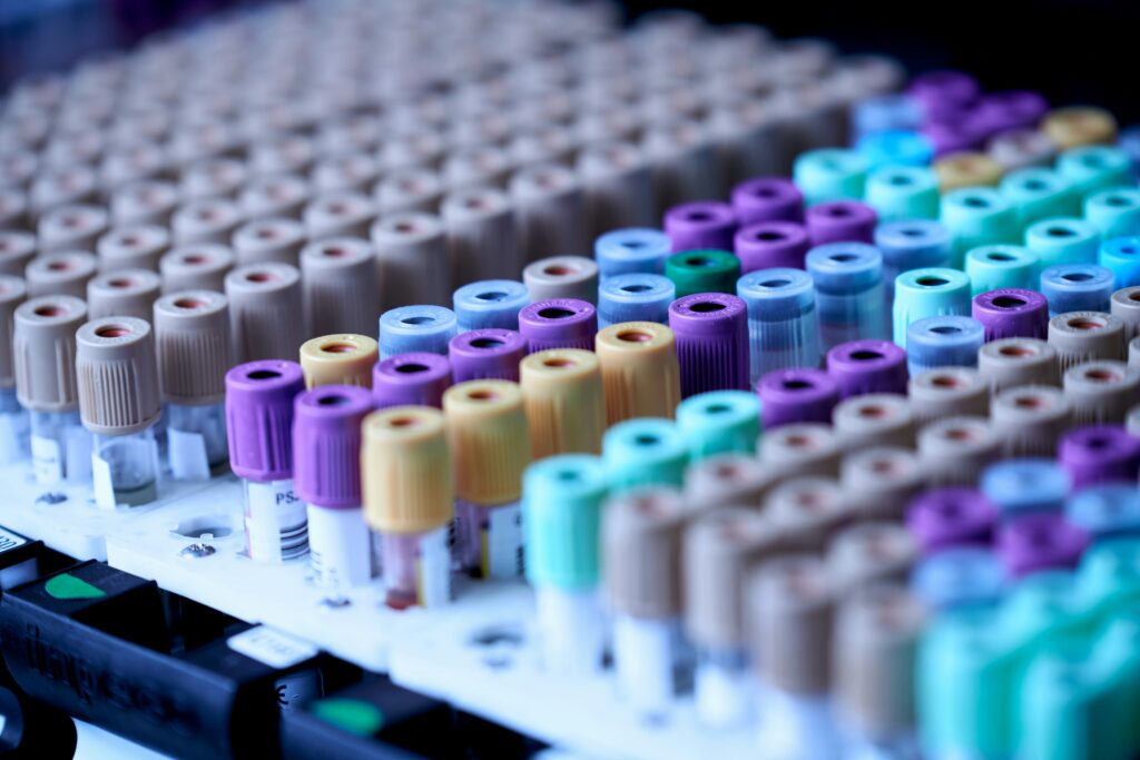 A1C Calculator: What Your Number Really Means